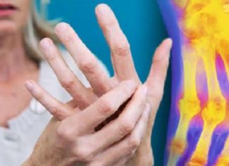 რატომ არ ვიცოდი ეს ადრე! ავადმყოფი სახსრების წამალი ყველა სახლშია. გააზიარეთ რეცეპტი!