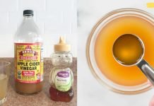 ვაშლის ძმრის წარმოუდგენელი სარგებელი ჯანმრთელობისთვის! საოცრად სასარგებლო პროდუქტი..