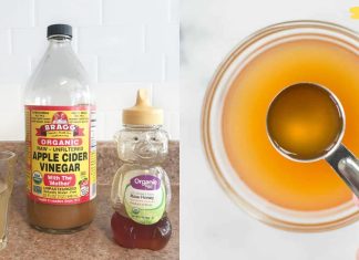 ვაშლის ძმრის წარმოუდგენელი სარგებელი ჯანმრთელობისთვის! საოცრად სასარგებლო პროდუქტი..