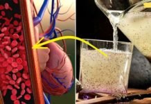 დალიეთ სურნელოვანი დეკორქცია დღეში სამჯერ და 4 კვირის შემდეგ დაივიწყებთ წნევის მატებას.