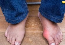 როგორ ეფექტურად ავიცილოთ თავიდან პოდაგრა და სახსრების ტკივილი ორგანიზმიდან კრისტალიზებული შარდმჟავას მოცილებით!