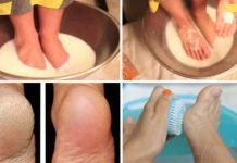 მან ფეხები რძისა და სოდის ნარევში მოათავსა- შედეგი ფენომენალურია! ფანტასტიკური აღმოჩენა!