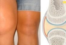 სახსრების ხრტილის აღდგენა ხალხური საშუალებებით! საჭირო ინფორმაციაა!