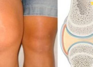 სახსრების ხრტილის აღდგენა ხალხური საშუალებებით! საჭირო ინფორმაციაა!