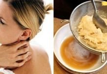 ინსტრუმენტი, რომელიც დაგეხმარებათ კისერზე მარილის ყველაზე ქრონიკული დეპოზიტების მოცილებაშიც კი