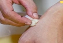 ეს ბიჭი კვირაში ორჯერ ისვამდა ხელებზე ვაშლის ძმარს… ასე უმკურნალა მან სახსრების ტკივილს.. დღეს საღამოს ვეცდები მეც იგივე გავაკეთო!