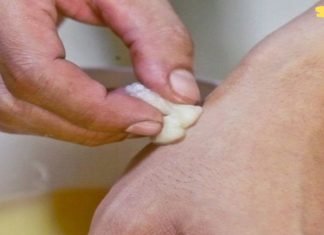 ეს ბიჭი კვირაში ორჯერ ისვამდა ხელებზე ვაშლის ძმარს… ასე უმკურნალა მან სახსრების ტკივილს.. დღეს საღამოს ვეცდები მეც იგივე გავაკეთო!