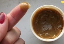 მუხლი გტკივა? მედიკამენტური მკურნალობა არ მუშაობს? ეს მეთოდი აუცილებლად დაგეხმარებათ თავიდან აიცილოთ გაუსაძლისი ტკივილი…