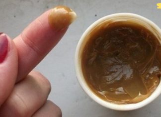 მუხლი გტკივა? მედიკამენტური მკურნალობა არ მუშაობს? ეს მეთოდი აუცილებლად დაგეხმარებათ თავიდან აიცილოთ გაუსაძლისი ტკივილი…