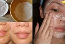 ლაქები, აკნე, ნაწიბურები და ნაოჭები გაქრება ამ ნიღბის მეორე გამოყენების შემდეგ! აღფრთოვანებული ვარ!