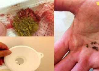 ამ ხალხური საშუალების გამოყენებით- თირკმელებიდან ყველა ქვას მოაცილებთ!!