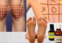 იოდის ბადე: მარტივი ხაზების სამკურნალო თვისებები! მისი ეფექტურობა დადასტურებულია!