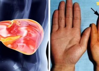 აუცილებლად წაიკითხეთ ეს სტატია! ღვიძის დაზიანების მაფრთხილებელი ნიშნები, რომლებიც არავითარ შემთხვევაში არ უნდა უგულებელყოთ!!