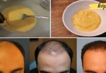 მან შეურია ბანანი და ლუდი და წაისვა თმაზე – შედეგი საოცარია! აღარ არის საჭირო ამ პრობლემაზე ფიქრი!