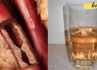 ეს სასმელი გაწმენდს არტერიებს და გიხსნით გულის დაავადებებისგან!
