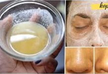 თუ გსურთ მნიშვნელოვნად გააუმჯობესოთ თქვენი კანის მდგომარეობა, უნდა სცადოთ საცხობი სოდის გამოყენების შემდეგი გზები, რათა გქონდეთ გლუვი, ახალგაზრდული და უნაკლო კანი.