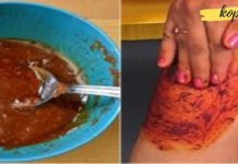 ეს ზეთი ტკივილს 15 წუთში მოგიხსნით! წარმოუდგენლად სწრაფად იგრძნობთ შვებას!