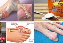 როგორ ავიცილოთ თავიდან პოდაგრა და სახსრების ტკივილი ორგანიზმიდან შარდმჟავას გამოდევნით! ეს მართლაც წარმოუდგენლად ეფექტურია!