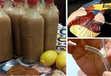 იჩქარე! ეს სტატია შეიძლება ძალიან მალე წაიშალოს ინტერნეტიდან, რადგან ის ნამდვილად მუშაობს! საოცარი წამალია!