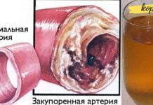 თუ ამ სასმელს ყოველ დღე დალევ, შენი სისხლძარღვები იმუშავებს საათივით!