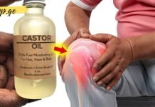 მარტივი ხრიკი ართრიტის, ზურგის ტკივილისა და რადიკულიტის შესამსუბუქებლად! ეს მეთოდი ნებისმიერ ტკივილგამაყუჩებელზე უკეთ მოქმედებს!