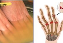 თუ თქვენ განიცდით აუტანელ და საშინელ ტკივილს ხელებსა და სახსრებში. თუ გაქვთ ართრიტი. ეს ეფექტური ხალხური მეთოდი დაგეხმარებათ…