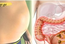 მოიშორეთ შებერილობა და დაიკლეთ წონაში ამ საოცარი რეცეპტით. ეს არის მიზეზი, რის გამოც გრძნობთ შებერილობას!