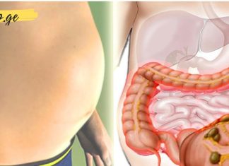 მოიშორეთ შებერილობა და დაიკლეთ წონაში ამ საოცარი რეცეპტით. ეს არის მიზეზი, რის გამოც გრძნობთ შებერილობას!