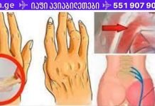 ეს ნაკლებად ცნობილი ზეთი ნებისმიერ ტკივილგამაყუჩებელზე უკეთესად გაგიყუჩებთ ართრიტის, რადიკულიტისა და ზურგის ტკივილს! მისი ეფექტურობა დადასტურებულია!