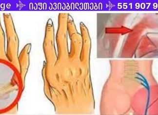 ეს ნაკლებად ცნობილი ზეთი ნებისმიერ ტკივილგამაყუჩებელზე უკეთესად გაგიყუჩებთ ართრიტის, რადიკულიტისა და ზურგის ტკივილს! მისი ეფექტურობა დადასტურებულია!