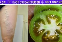 მე ვარიკოზულ ვენებს მწვანე პომიდორის გამოყენებით ვუმკურნალე! თუ შენც გაწუხებს ეს პრობლემა გირჩევ სცადო!!.