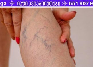 რა უნდა გააკეთო, თუ ფეხზე ვენები გასკდება! ამის ცოდნა აუცილებელია!