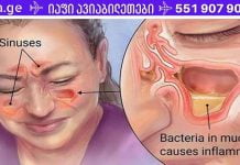 მოიშორეთ სინუსიტი რამდენიმე წუთში! ეს რეცეპტი ქრონიკულ შემთხვევებშიც კი დაგეხმარებათ!