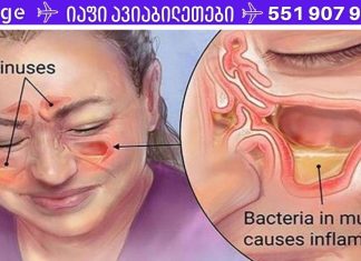 მოიშორეთ სინუსიტი რამდენიმე წუთში! ეს რეცეპტი ქრონიკულ შემთხვევებშიც კი დაგეხმარებათ!