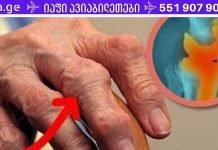 მოიშორეთ სახსრების ტკივილი მხოლოდ 1 დღეში ამ საოცარი რეცეპტით! გაათავისუფლდით ტკივილისგან წუთებში!