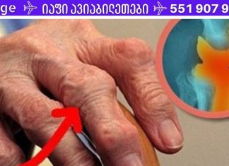 მოიშორეთ სახსრების ტკივილი მხოლოდ 1 დღეში ამ საოცარი რეცეპტით! გაათავისუფლდით ტკივილისგან წუთებში!