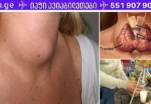 აი, როგორ განკურნოთ ფარისებრი ჯირკვალი მხოლოდ ერთი ინგრედიენტით! ამას ექიმები რატომღაც არ ამბობენ!