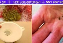 უბრალოდ ნახეთ, როგორ გამოდის ქვები თირკმელებიდან ამ ბუნებრივი საშუალების გამოყენებით!