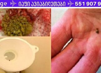 უბრალოდ ნახეთ, როგორ გამოდის ქვები თირკმელებიდან ამ ბუნებრივი საშუალების გამოყენებით!