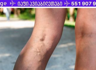 თუ ვარიკოზული ვენები გაწუხებს, აუცილებლად დაიწყე ამ ვარჯიშების გაკეთება!