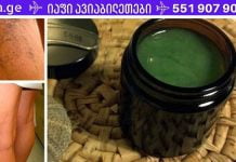 დედამ ბებიის მარტივი რეცეპტით მოიშორა ვარიკოზული ვენები. ღირს ცდა!