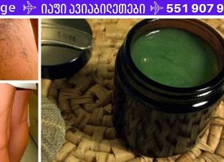 დედამ ბებიის მარტივი რეცეპტით მოიშორა ვარიკოზული ვენები. ღირს ცდა!