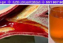 კინაღამ მოვკვდი გულის შეტევით დახშული არტერიების გამო. ეს სასმელი დაეხმარა მათ გაწმენდაში! ამას ყურადღება უნდა მიაქციოთ!!