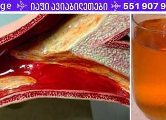 კინაღამ მოვკვდი გულის შეტევით დახშული არტერიების გამო. ეს სასმელი დაეხმარა მათ გაწმენდაში! ამას ყურადღება უნდა მიაქციოთ!!