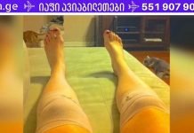 მან გაიკეთა ეს კომპრესი და მჭიდროდ შემოიხვია მუხლები! ერთი საათის შემდეგ მისი ფეხის მდგომარეობა უკეთესობისკენ შეიცვალა…