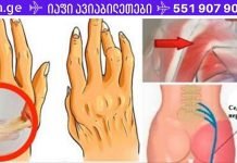 მარტივი ხრიკი ართრიტის, ზურგის ტკივილისა და რადიკულიტის შესამსუბუქებლად! ნებისმიერ ტკივილგამაყუჩებელზე უკეთ მოქმედებს!