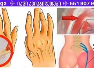 მარტივი ხრიკი ართრიტის, ზურგის ტკივილისა და რადიკულიტის შესამსუბუქებლად! ნებისმიერ ტკივილგამაყუჩებელზე უკეთ მოქმედებს!