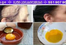 ჯადოსნური რეცეპტი თმის სწრაფი ზრდისთვის! ამისთვის მხოლოდ 3 ინგრედიენტია საჭირო!