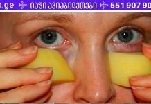 მარმარილოს კანი ნაოჭების გარეშე! ხელნაკეთი ნიღაბი თვალის ირგვლივ კანისთვის! საკუთარ თავზე გამოვცადე მისი ჯადოსნური შესაძლებლობები!