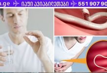 თუ ორგანიზმიდან პარაზიტების მოცილება გინდა, გამოიყენე ამ რეცეპტებიდან რომელიმე! უძლიერესი საშუალებებია!